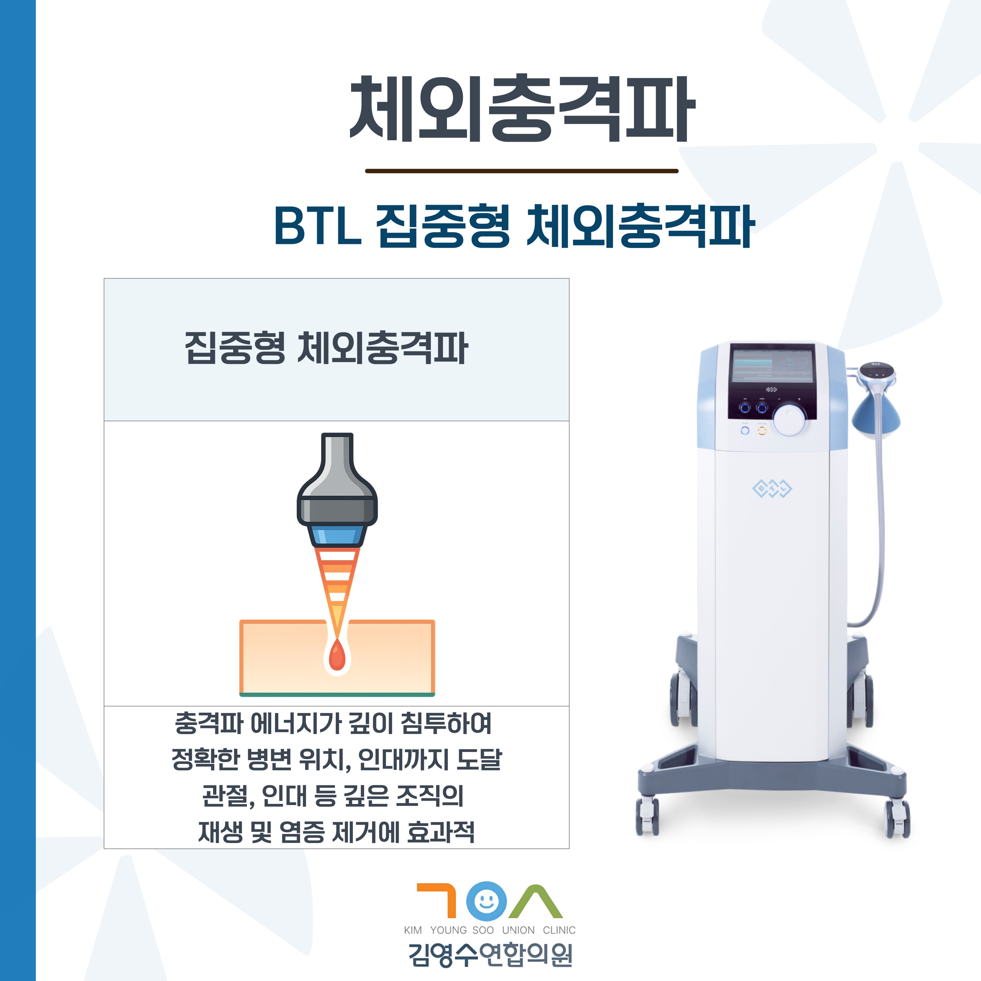 체외충격파-007.jpg